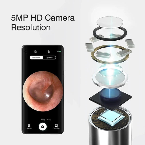 Wireless 5MP HD Ear Camera with WiFi for Android & iPhone – Portable Ear Scope for Safe Cleaning & Inspection