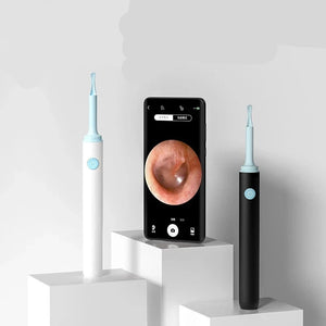 Wireless 5MP HD Ear Camera with WiFi for Android & iPhone – Portable Ear Scope for Safe Cleaning & Inspection